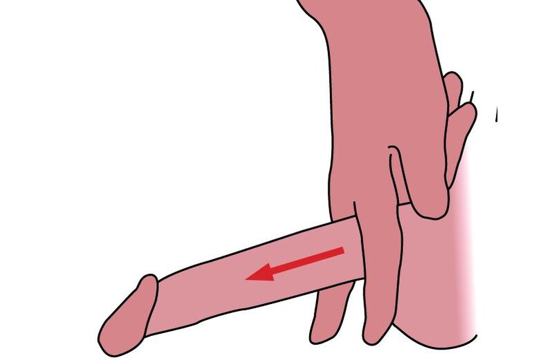 tehnica de întindere a penisului